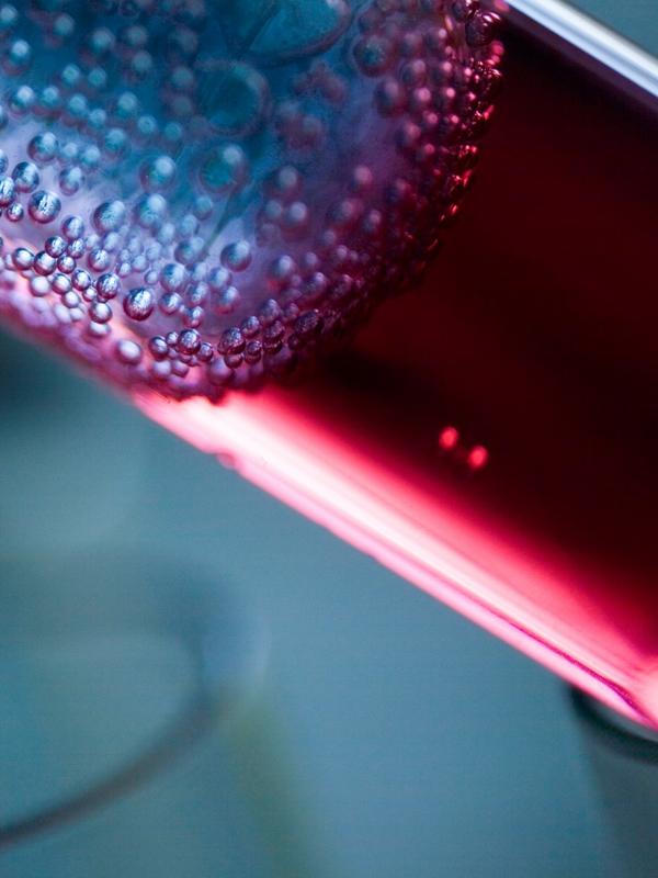 Blutabnahme im Labor