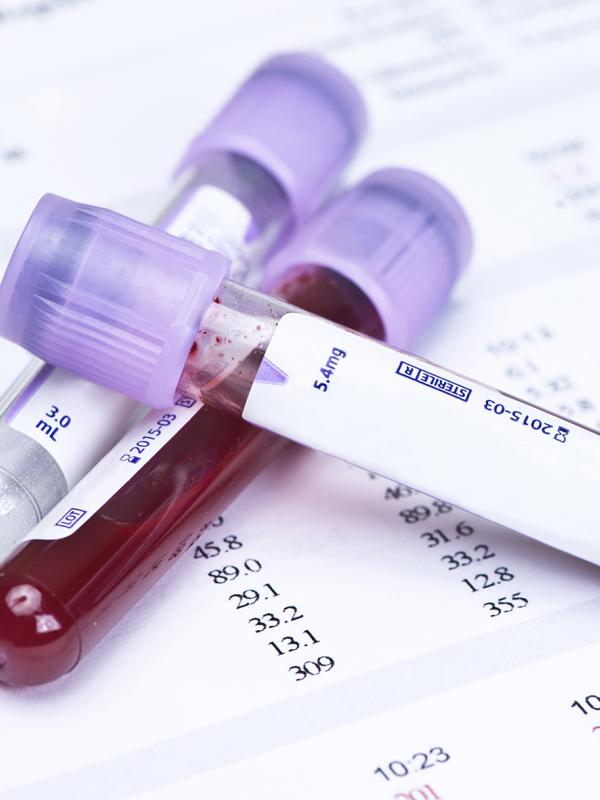 Blutröhrchen für Blutanalyse im Labor