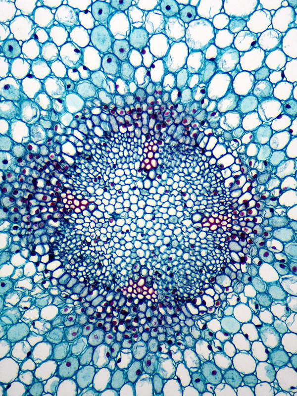 Silent Inflammation als Ursache von Krebserkrankungen 