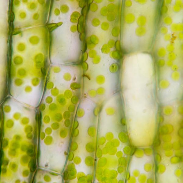 Webinar Mikronährstoffe: Mangel im Überfluss?